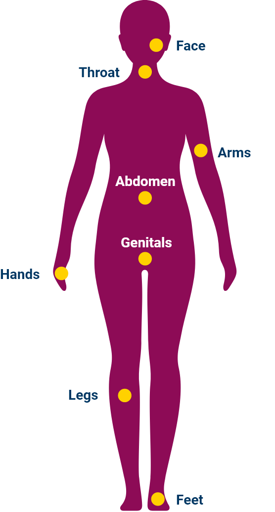 image of common body locations